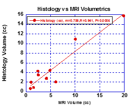 Plot of Tumor Volume taken from Histogram vs Volume from MRI (R=0.94).